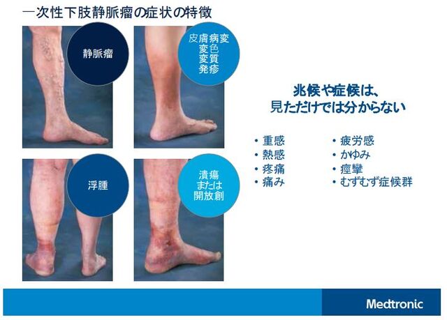 兆候や症候は見ただけでは分からない